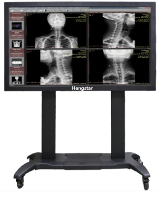 Tablet medico: una semplice guida all'acquisto per ospedali e cliniche